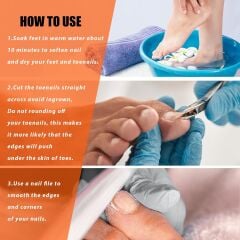 Tırnak Makası Kalın ve Batık Tırnaklar İçin